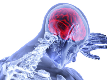 Trauma Craneoencefálico